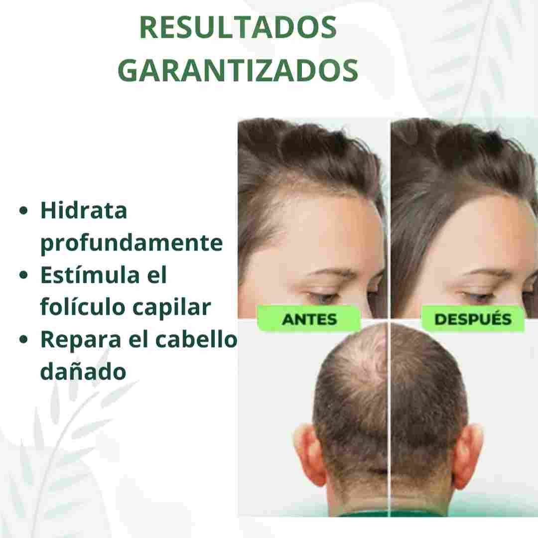 Spray Capilar OUHOE – ¡Activa el crecimiento de tu cabello en semanas!