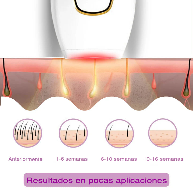 Depiladora IPL Inteligente