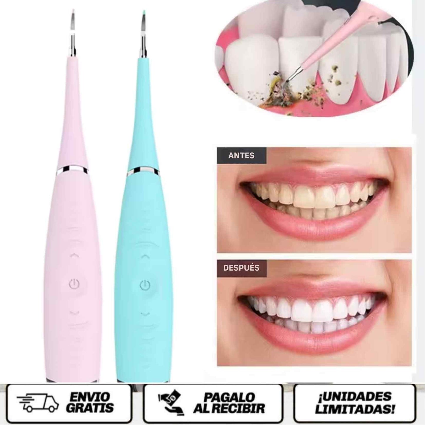 SarroClean Pro™ La forma más avanzada y práctica de devolverle a tu sonrisa su brillo natural desde casa.