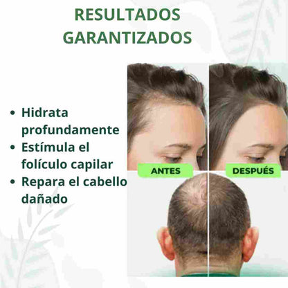 Spray Capilar OUHOE – ¡Activa el crecimiento de tu cabello en semanas!