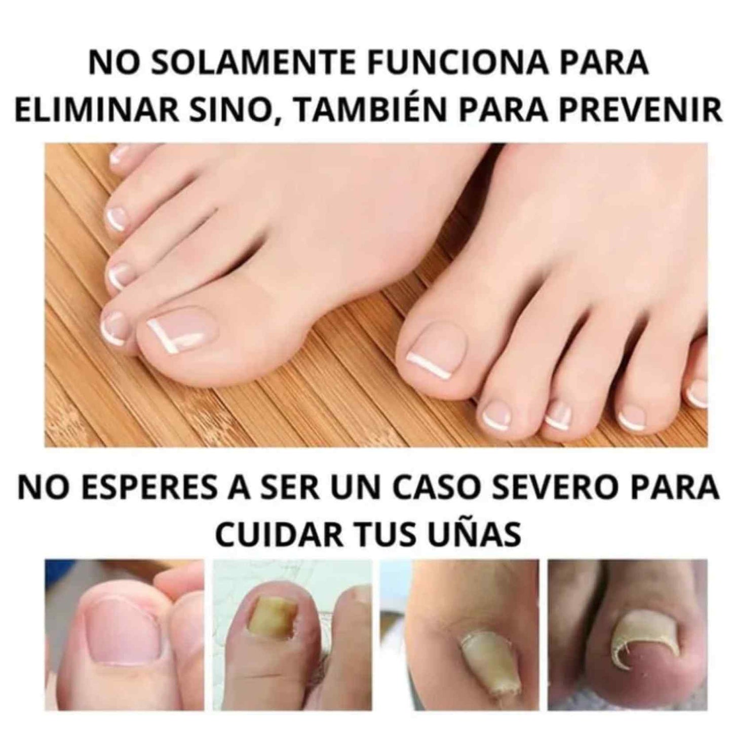 ToenailX™ Repair - El escudo natural y potente que devuelve la salud y el brillo a tus uñas