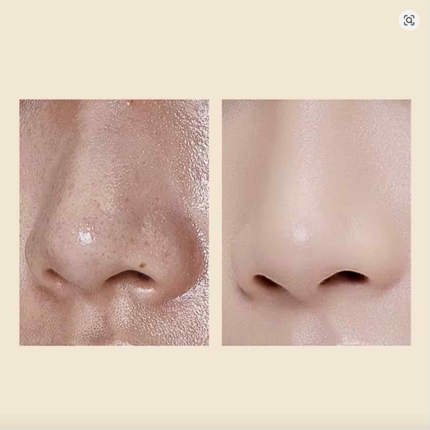 RiceGlow™ Duo - El dúo japonés que transforma tu piel… sin exfoliarla a la fuerza.