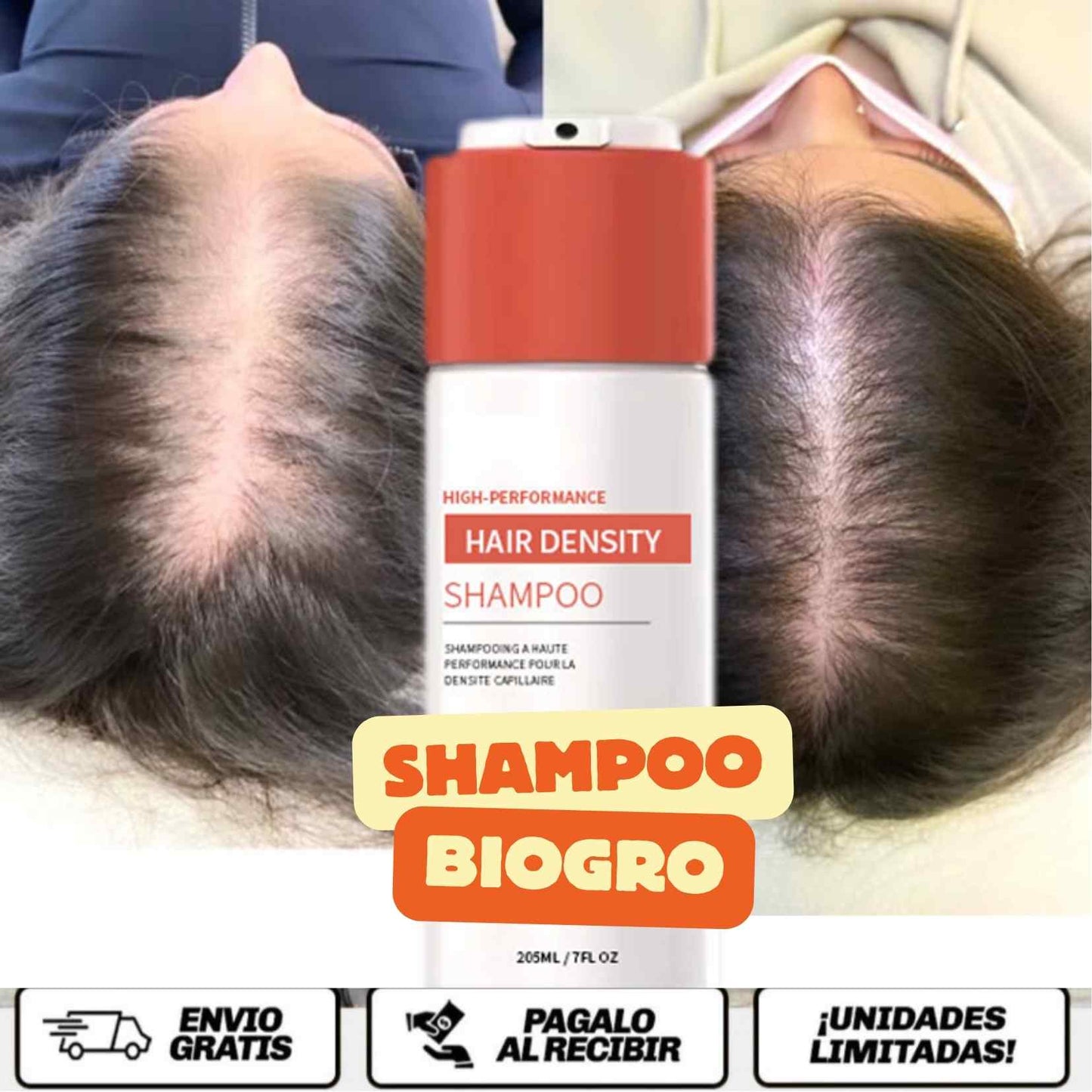 BioGro™ Shampoo El champú anticaida, estimula el crecimiento, purifica el cuero cabelludo y deja tu cabello con cuerpo, brillo y vida real.