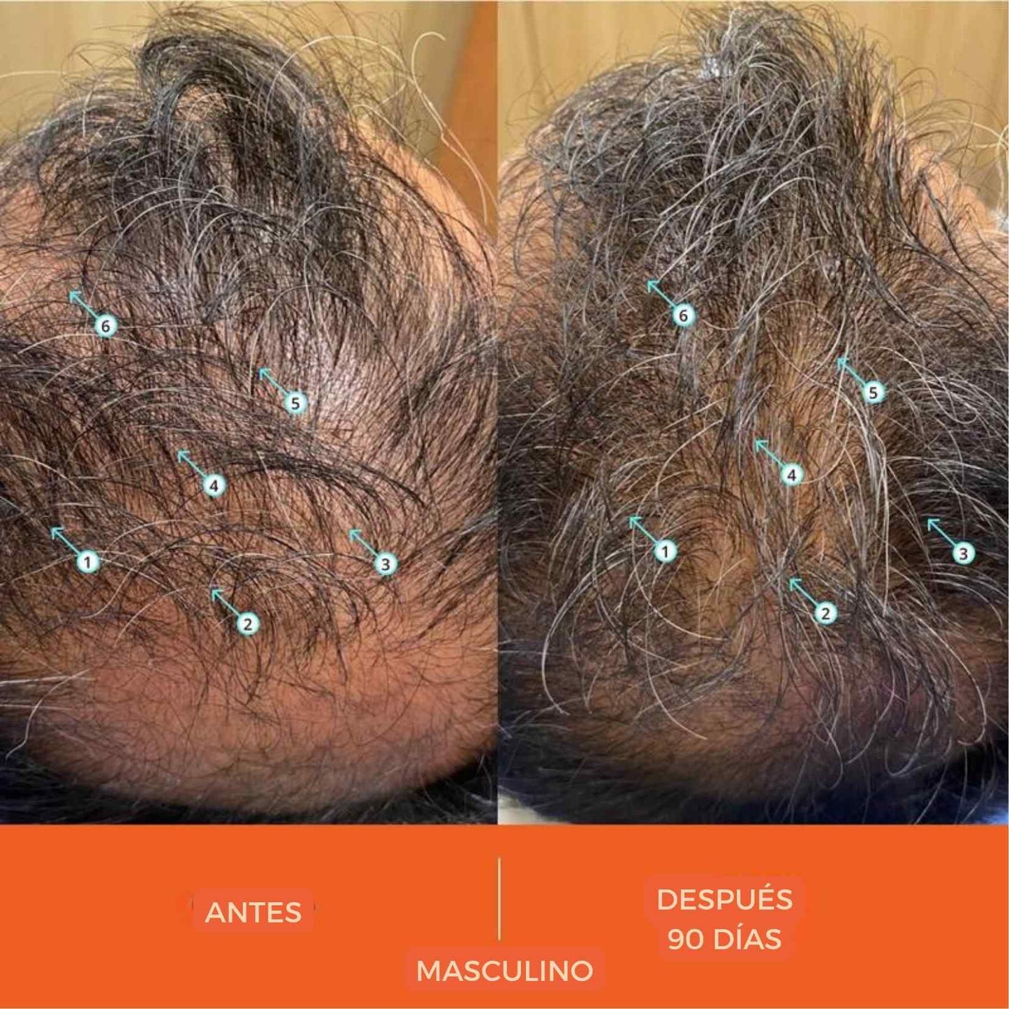 BioGro™ Shampoo El champú anticaida, estimula el crecimiento, purifica el cuero cabelludo y deja tu cabello con cuerpo, brillo y vida real.