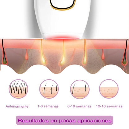 Depiladora IPL Inteligente